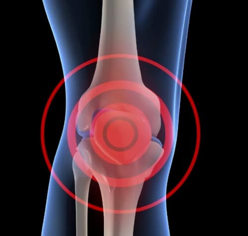 Flexosamine medicamento opiniones