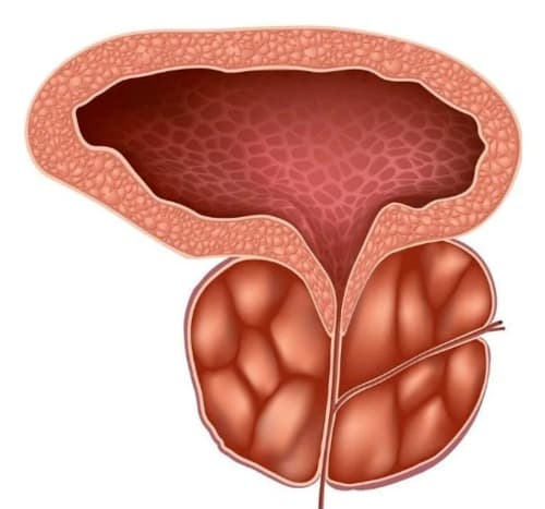 Prostatricum Plus donde lo venden
