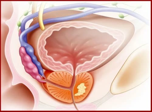 Vigorostate medicamento opiniones