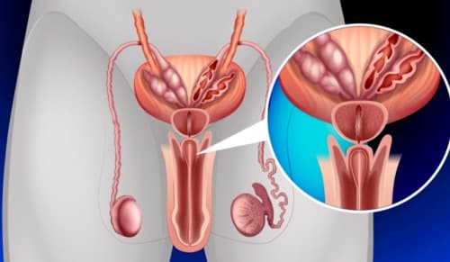 Prostalinex opiniones